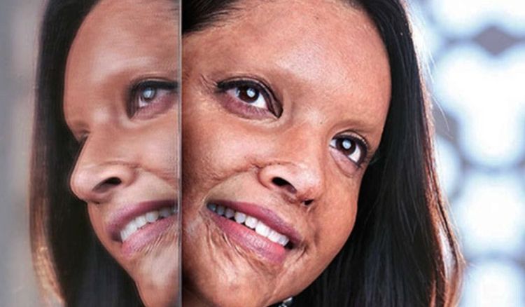 First look of deepika padukone as acid attack survivor laxmi agarwal from chhapaak