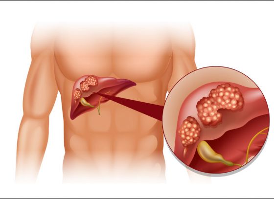 Liver Cancer Detection: লিভার ক্যানসার চিহ্নিত করার নতুন যন্ত্র আবিষ্কার করলেন ছত্তীসগঢ়ের দুই ছাত্র